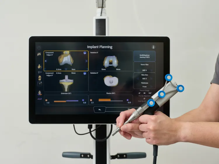 可立AI骨科機器人系統透過AI數據與即時3D建模，使醫師在術中能同步掌握骨骼結構與軟組織狀態，提高手術的精準度與安全性。