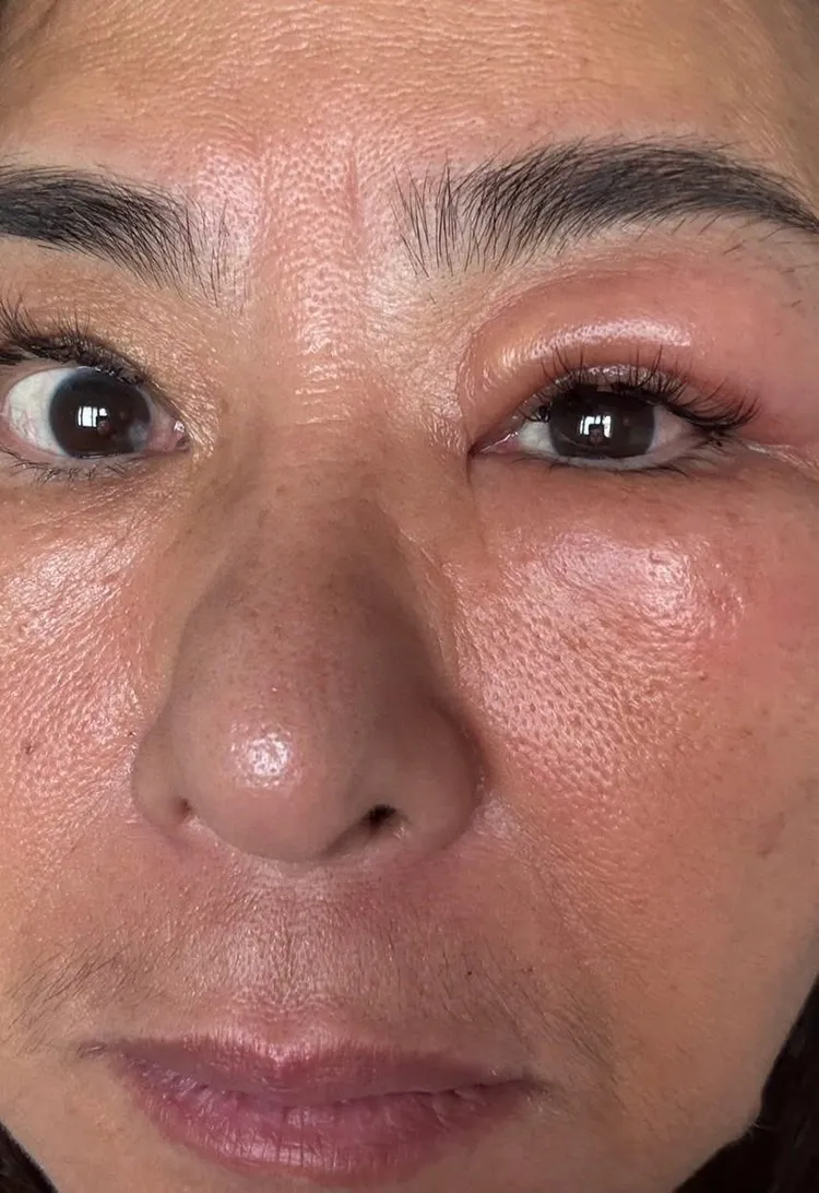 裘海正透露目前已消腫許多。摘自臉書