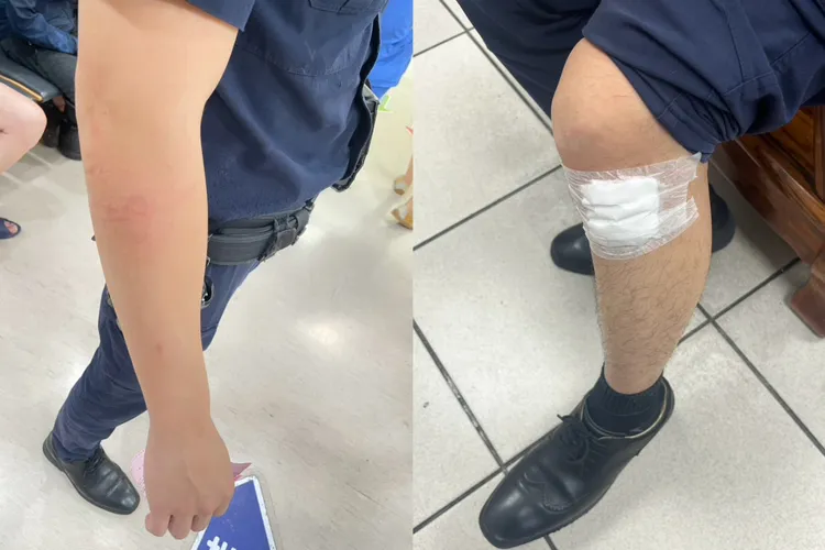 許姓、江姓員警分別手腳有擦挫傷。翻攝畫面