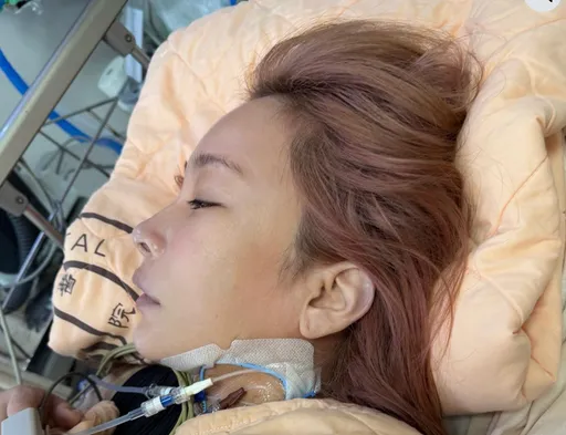 温嵐敗血性休克送醫搶救　閨蜜驚曝：她找不到血管只能從脖子打針