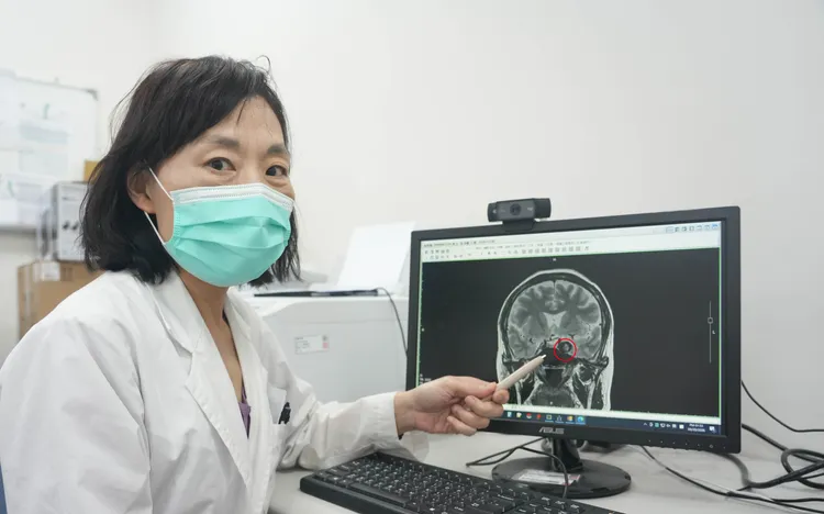 神經內科柯麗櫻醫師指出，陳小姐經血管攝影發現腦內竟藏著兩顆大型動脈瘤，造成動眼神經壓迫。光田醫院提供