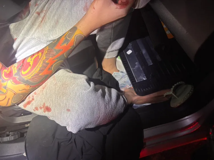 車手受傷。翻攝畫面