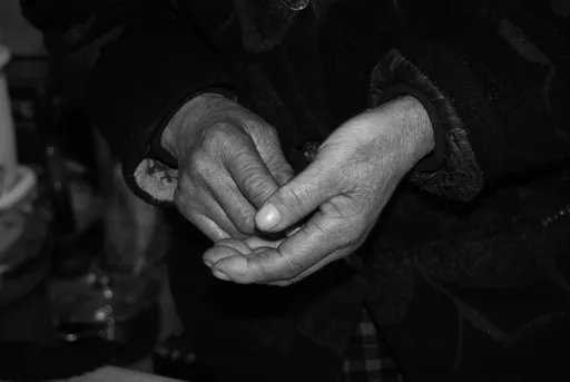 不只手抖！72歲帕金森患者重度憂鬱臥床不語　靠磁刺激治療重拾笑容