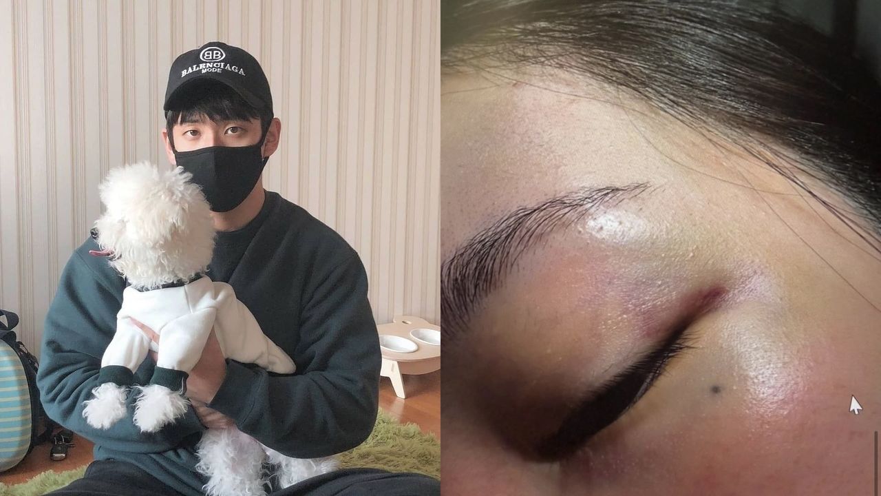 Jisoo大嫂斷開家暴尪確定離婚!吞一把藥嘆「快死了」引憂心
