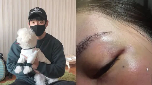 Jisoo大嫂斷開家暴尪確定離婚！吞一把藥嘆「快死了」引憂心