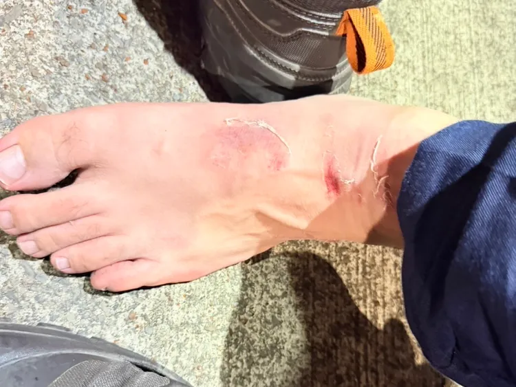 員警雙腳挫傷。翻攝畫面