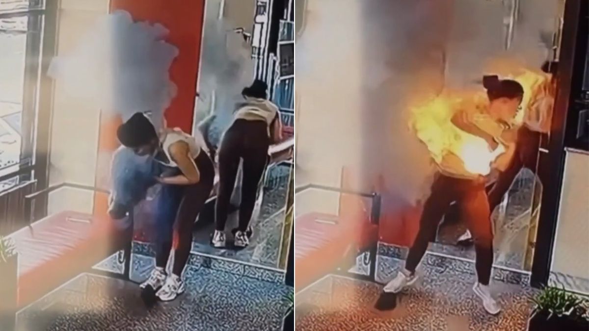 影片|女網紅「斜背包突變火球」灼頭頸 行動電源爆炸快速延燒