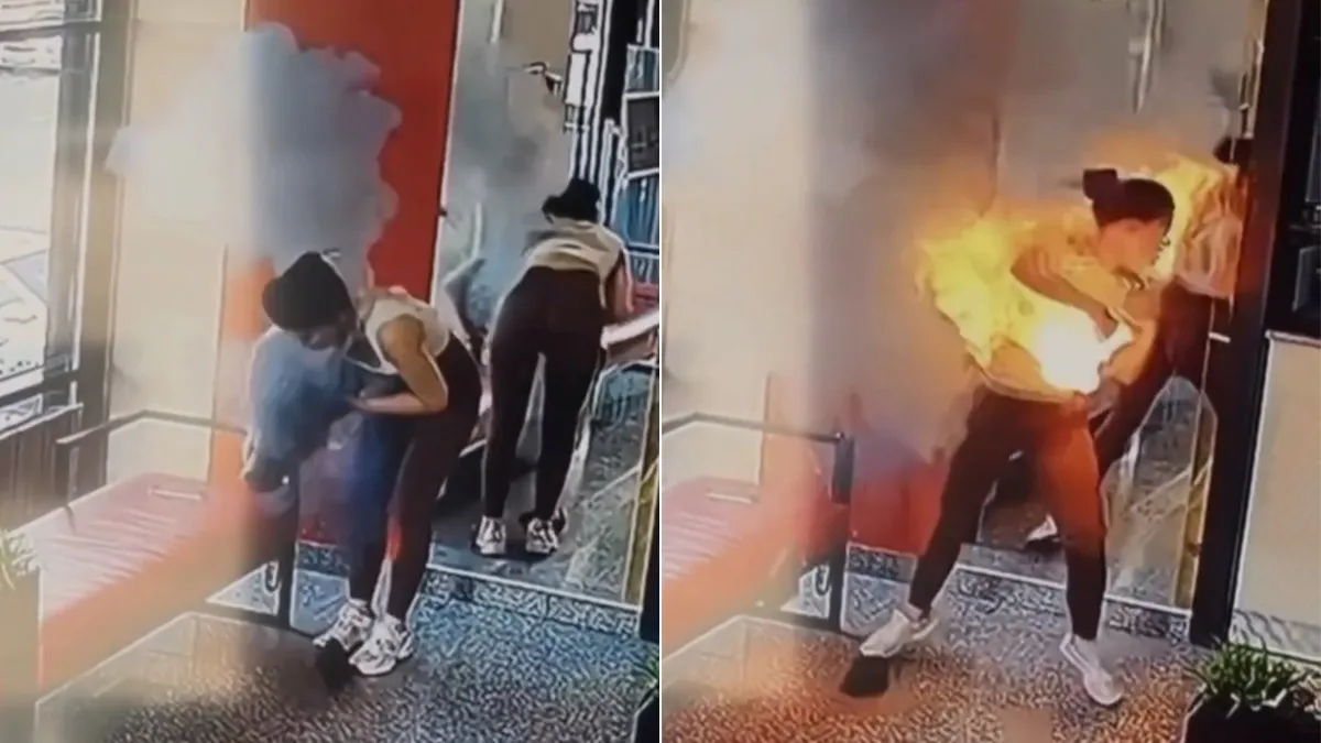 影片｜女網紅「斜背包突變火球」灼頭頸　行動電源爆炸快速延燒