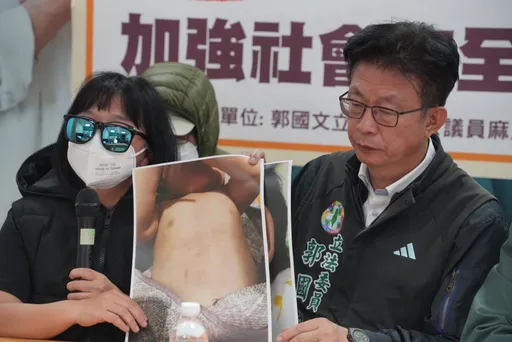 「剴剴案」台南版！男嬰腦萎縮、視力聽力難復原　惡保母續押2月
