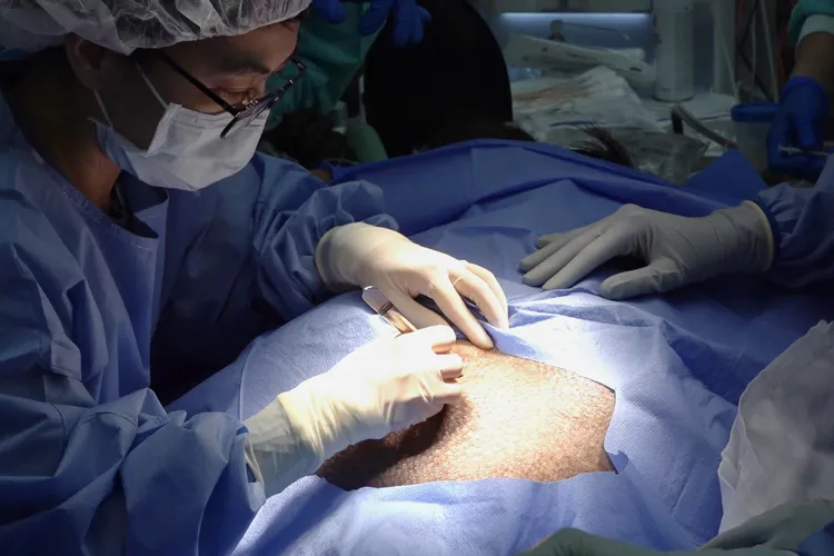 醫療與照養團隊經過審慎評估後，決定以計畫性剖腹產。北市動物園提供