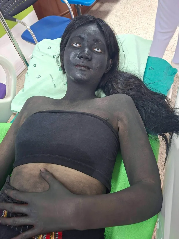 泰國一名女學生在校突發嚴重腹痛，救護人員趕抵現場，沒想到一看到她的模樣，當場嚇了一跳。翻攝泰國清邁象臉書