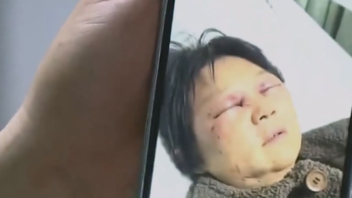 婆婆「不幫顧小孩」被媳婦打斷4肋骨 兒竟嗆活該:媽只顧談戀愛