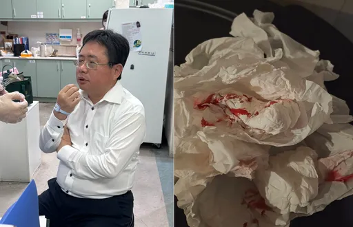 畫面曝光！矢板明夫台中演講遭黑衣人尾隨攻擊濺血　警方受理報案