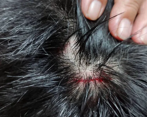 彰化又傳狗追人！男童騎車遭浪犬群攻　驚嚇摔車負傷狂奔800米脫險