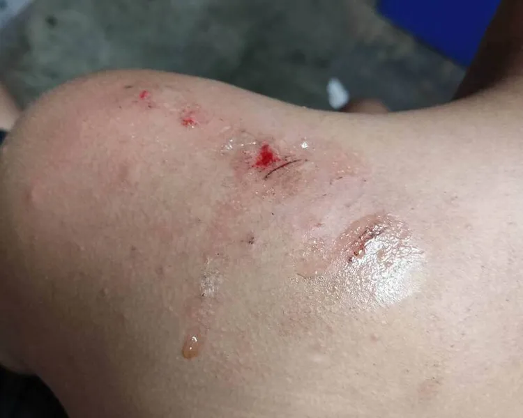 男童身體多處受傷。民眾提供