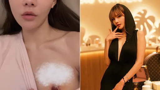 香港最強小三美乳「嚴重受損」　撩衣親曝吃安眠藥熟睡時遇禍