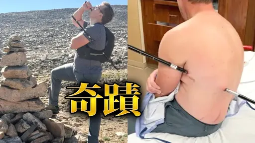 護理師遭登山杖刺穿胸腹　「插著」走6小時下山！醫揭保命關鍵