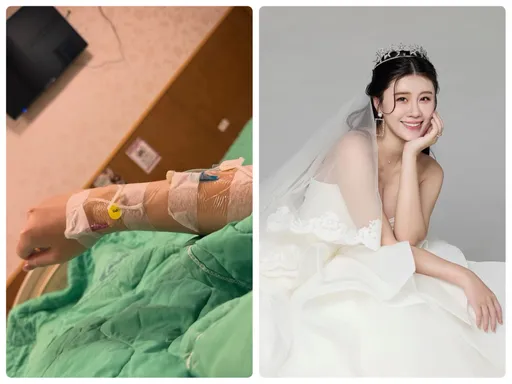 角頭女神懷孕才20周腹部痠痛　緊急送醫「子宮頸打開了」