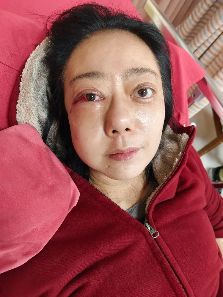 高慧君去年底突暈倒撞到臉骨折。資料照、經紀人提供