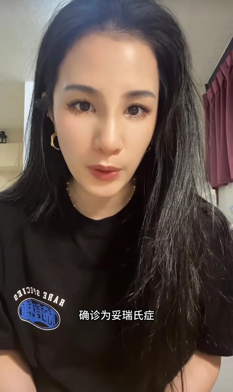 呆寶靜透過影片證實兒子確診妥瑞氏症。翻攝Threads