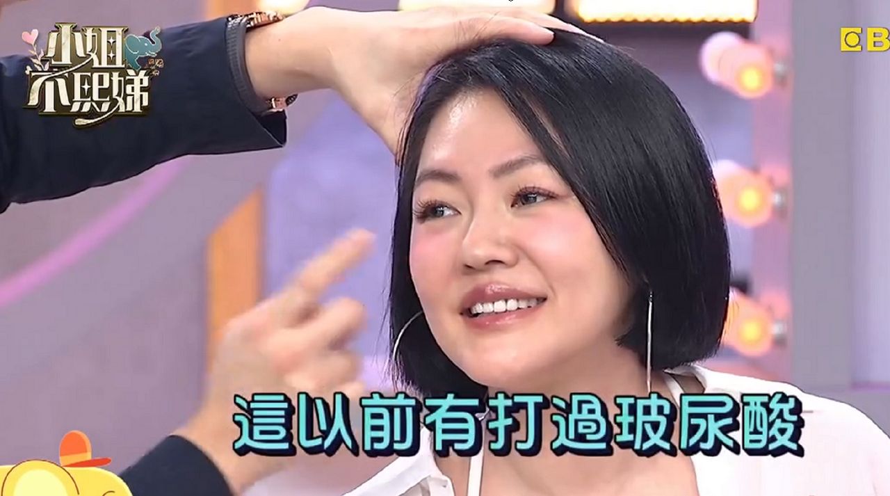 小S被醫生神手摸臉直言「打過玻尿酸」 做醫美被拆穿「有再注射過」
