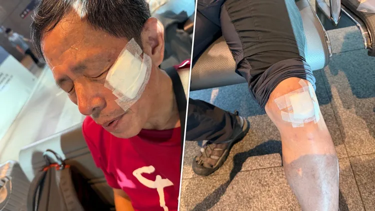 劉克襄為取回遺落在車廂內的背包，於高鐵台中站手扶梯上跌倒受傷。翻攝自劉克襄臉書