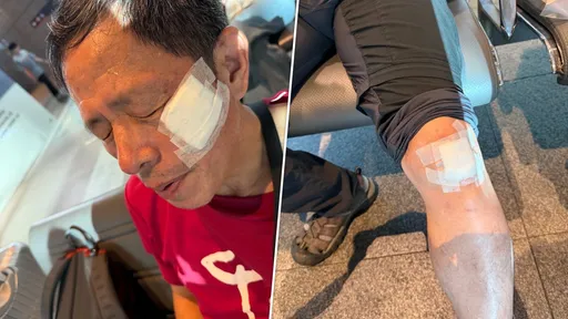 劉克襄高鐵台中站「往回衝」跌倒見血！傷勢照曝光