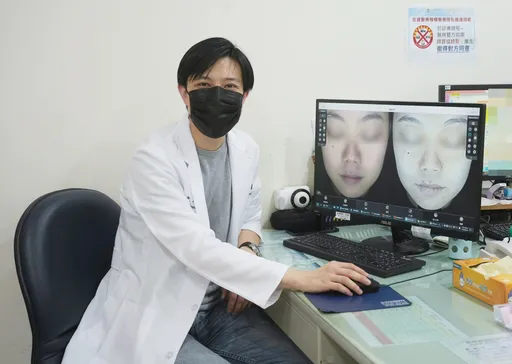 33歲女減重過頭驚見「瘦瘦針臉」　雙頰凹陷、掉髮急求醫