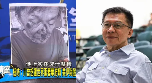 沈富雄重摔滿臉血慘況曝！　罕見「腎臟移植者才有的摔法」