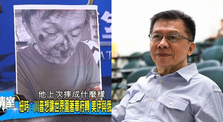 沈富雄分享自己重摔滿臉血的照片。翻攝少康戰情室YouTube、沈富雄臉書