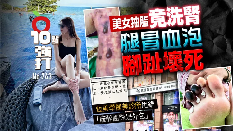 林姓美魔女想讓自己變得更好，進行抽脂及脂肪填補手術，竟搞到送急診還恐得終身洗腎，原本美好人生一夕變調。