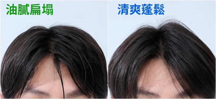 ▲根據品牌測試資料，100%受試者認同*使用後全天清爽控油、髮根清爽蓬鬆。