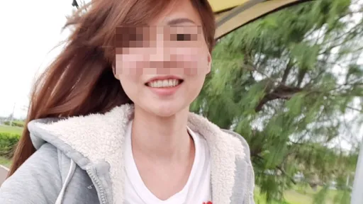 45歲女割眼袋麻醉後呼吸困難！胃部大出血搶救11天不治　家屬提告過失致死