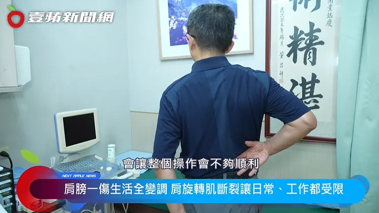 內科醫師王昶皓醫師也是肩旋轉肌斷裂的患者，在接受「再生貼片」的治療約半年後，自覺肩部狀況較過去穩定，手臂活動也逐漸回到原本的生活節奏。