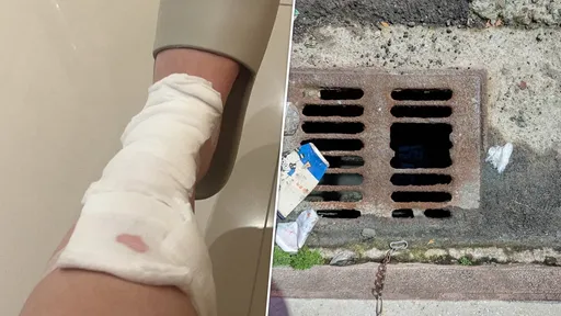 台中水溝蓋破洞害女師踩空掉落　小腿遭鏽蝕鐵片割傷縫3針