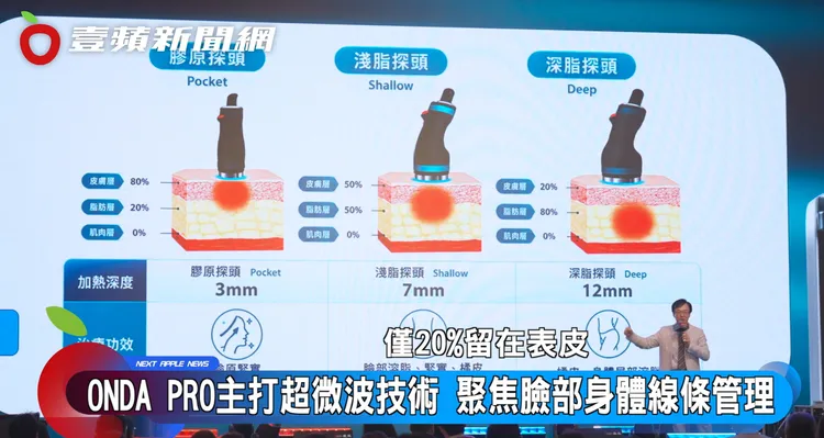 ONDA PRO昂達超微波主打超微波技術，共有三種不同探頭，約80%能量導向皮下深層脂肪層，可依個人條件規劃臉部輪廓及身體局部線條管理。