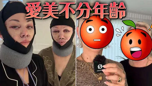 母女旅行變「一起拉皮」！40歲女揪69歲媽赴韓整形　術後照曝光