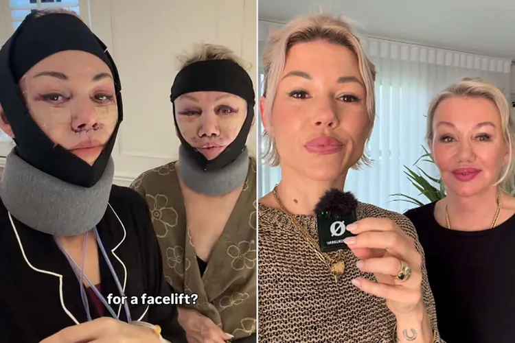 母女自認做完手術後更有自信素顏出門。翻攝IG@my40s_unfiltered