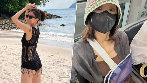 賈靜雯海邊解放蜜桃臀！罹滑囊炎手掛護具渡假