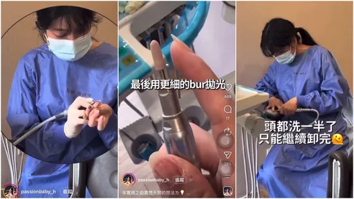 拿醫材「卸美甲」　美女牙醫道歉！一票網仍怒：真敢講