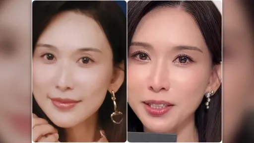 林志玲「電眼消失」？醫師PO對比圖點出真相