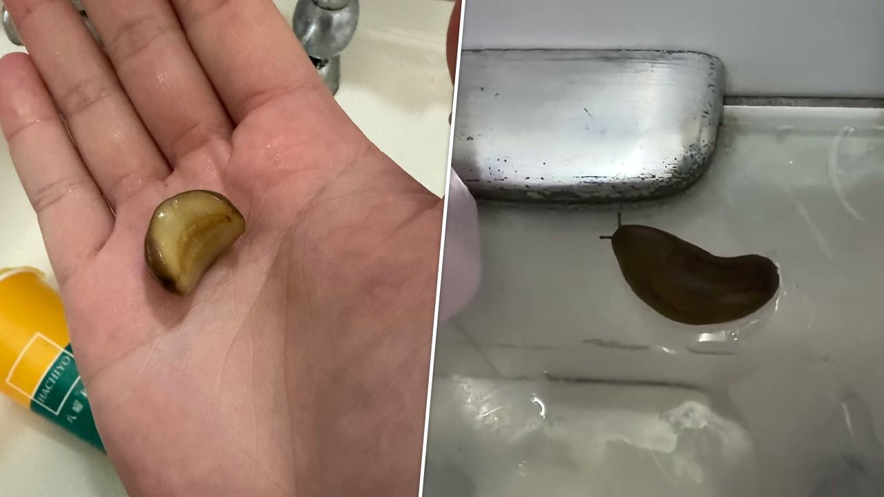 手搖飲喝完竟倒出「會動的活蛞蝓」 他嚇到連夜掛急診!八曜和茶致歉