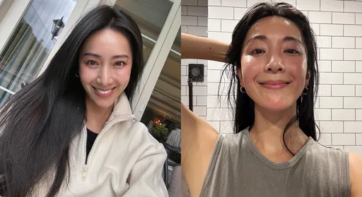 45歲隋棠自覺「倍速老化」　認了做醫美！術後素顏照曝光