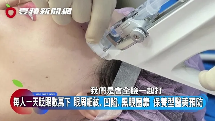 李俊儀醫師表示，水光針進行眼周保養時，通常也會搭配全臉一起進行。