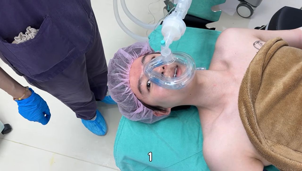 百萬YouTuber瑋瑋迎30歲生日 送自己動「乳房手術」:想了10多年了