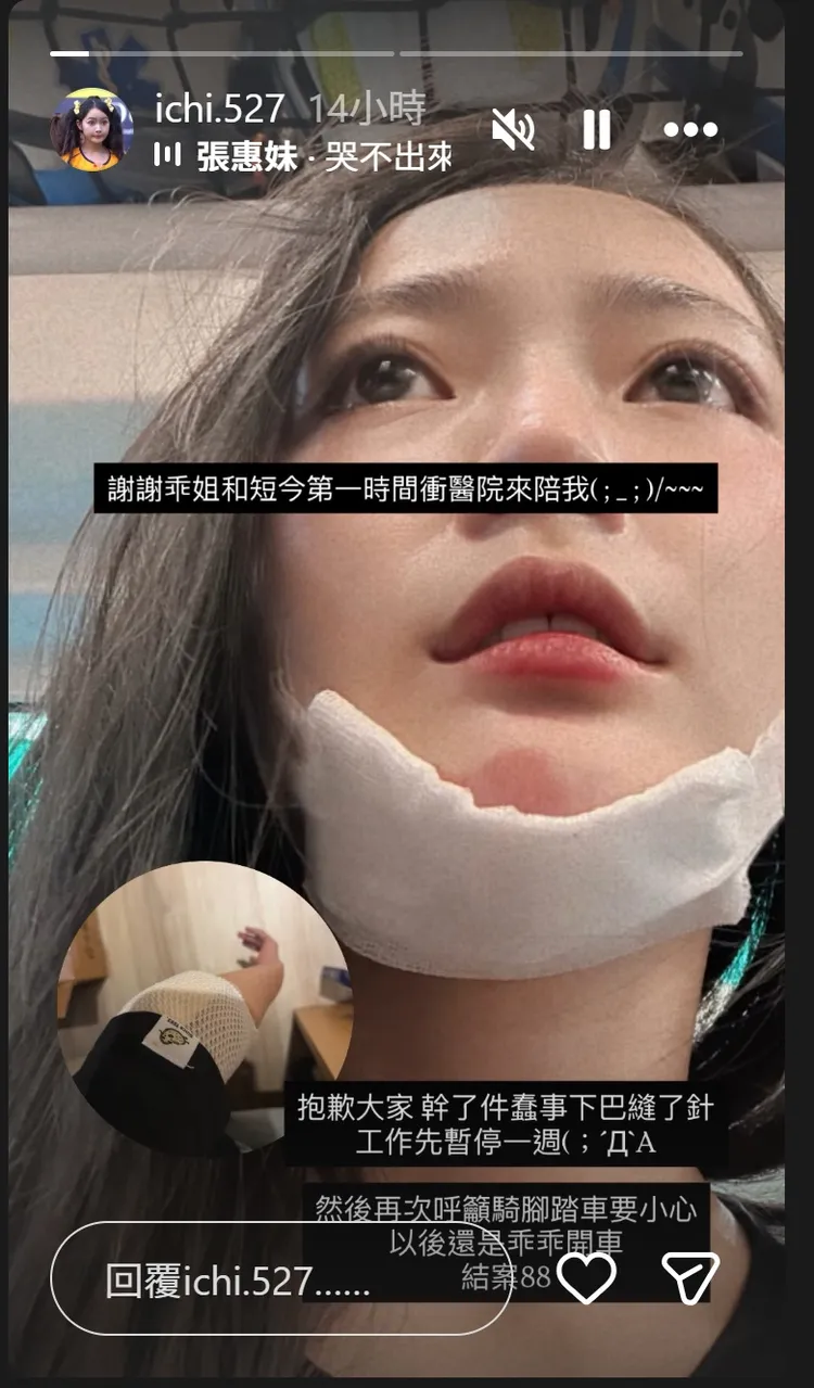 怡琪下巴縫針、手臂也用紗布包裹。翻攝怡琪IG