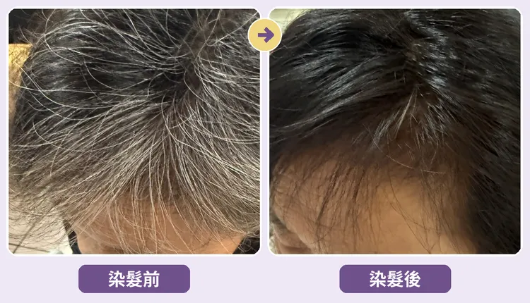 使用漢芳染髮霜後，能有效徹底遮蓋白髮，染後髮色自然均勻，柔順有光澤感。(試用68號黑栗棕)