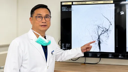 46歲女突「左側手腳無力、口齒不清」　竟是乾燥症引發腦中風